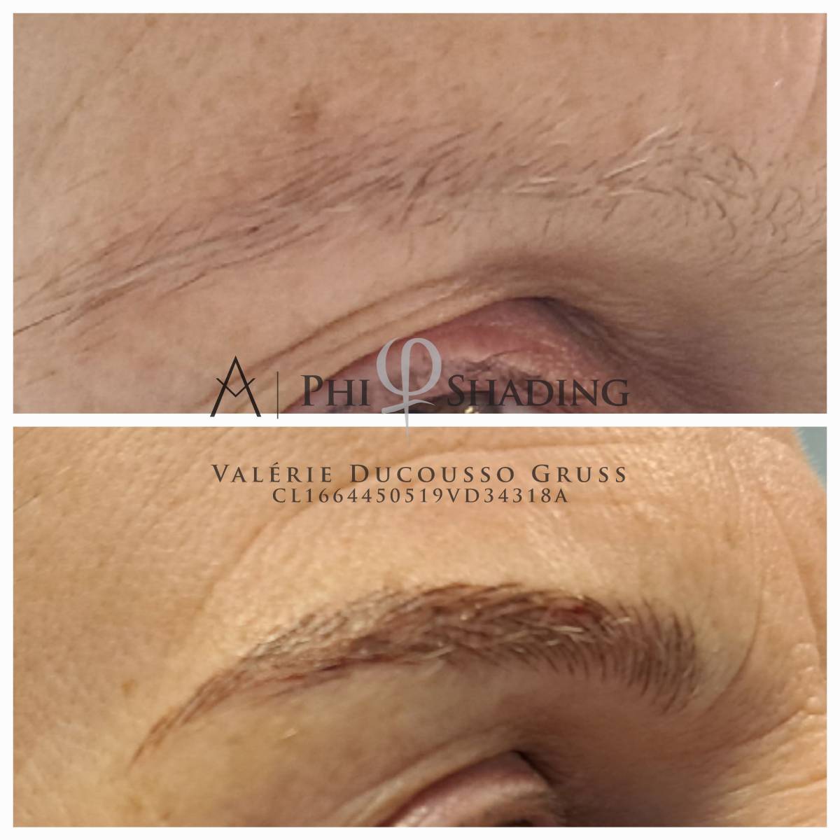 Effacement progressif